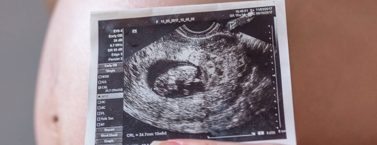 relacionan la contaminacion del aire con cambios en el desarrollo cerebral fetal