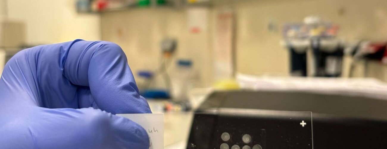 una tecnica permite analizar millones de celulas individuales sin necesidad de secuenciarlas