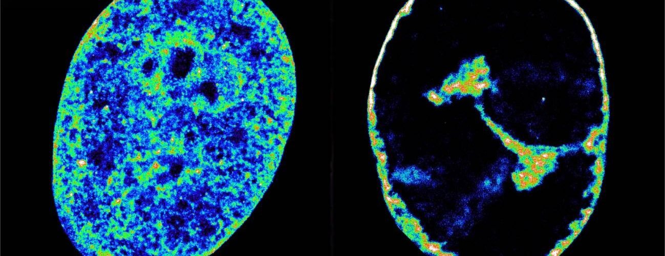 asi reorganiza el herpes labial el genoma humano para propagarse