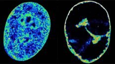asi reorganiza el herpes labial el genoma humano para propagarse