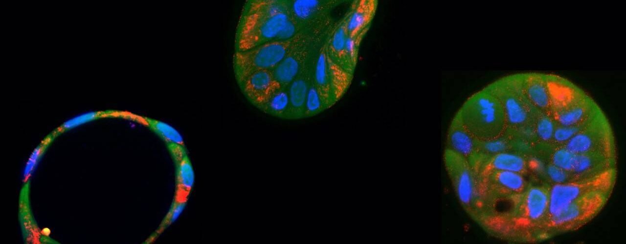 un nuevo editor genetico corrige mutaciones mitocondriales daninas en celulas humanas