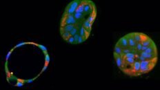 un nuevo editor genetico corrige mutaciones mitocondriales daninas en celulas humanas