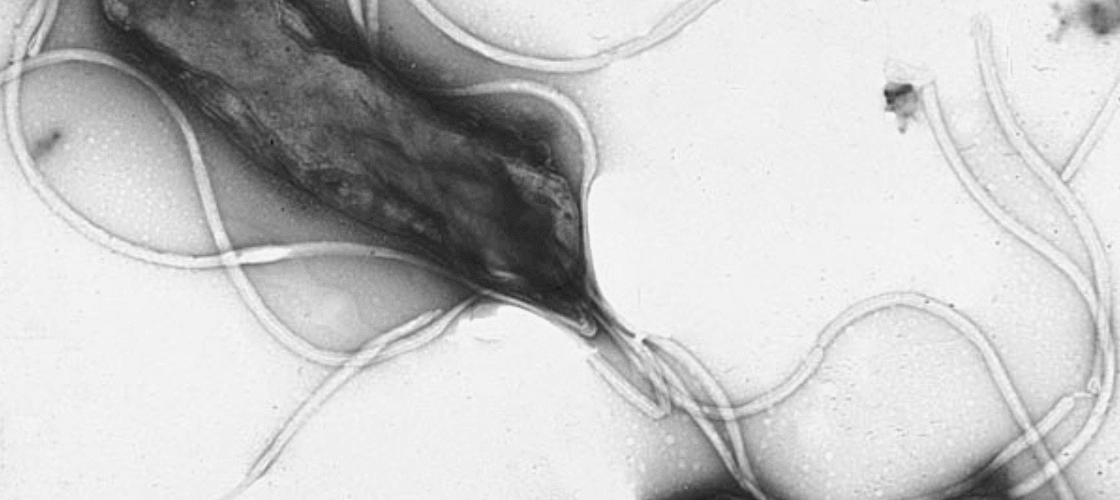 la helicobacter pylori podria causar casi 12 millones de casos de cancer de estomago