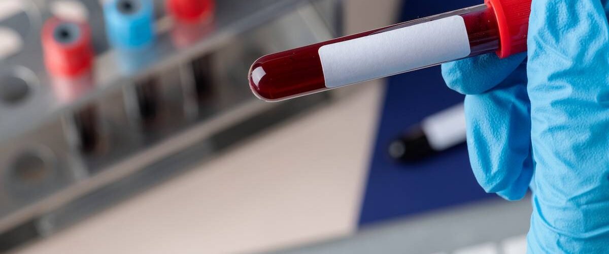 desarrollan una prueba que detecta tumores en estadios iniciales en muestras de sangre