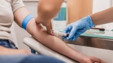 un nuevo analisis genetico predice el riesgo de obesidad adulta desde la infancia