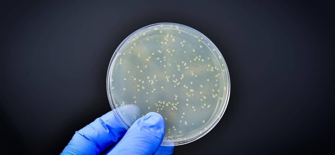 la mayoria de los genes resistentes a antibioticos circulan en la produccion alimentaria