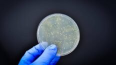 la mayoria de los genes resistentes a antibioticos circulan en la produccion alimentaria