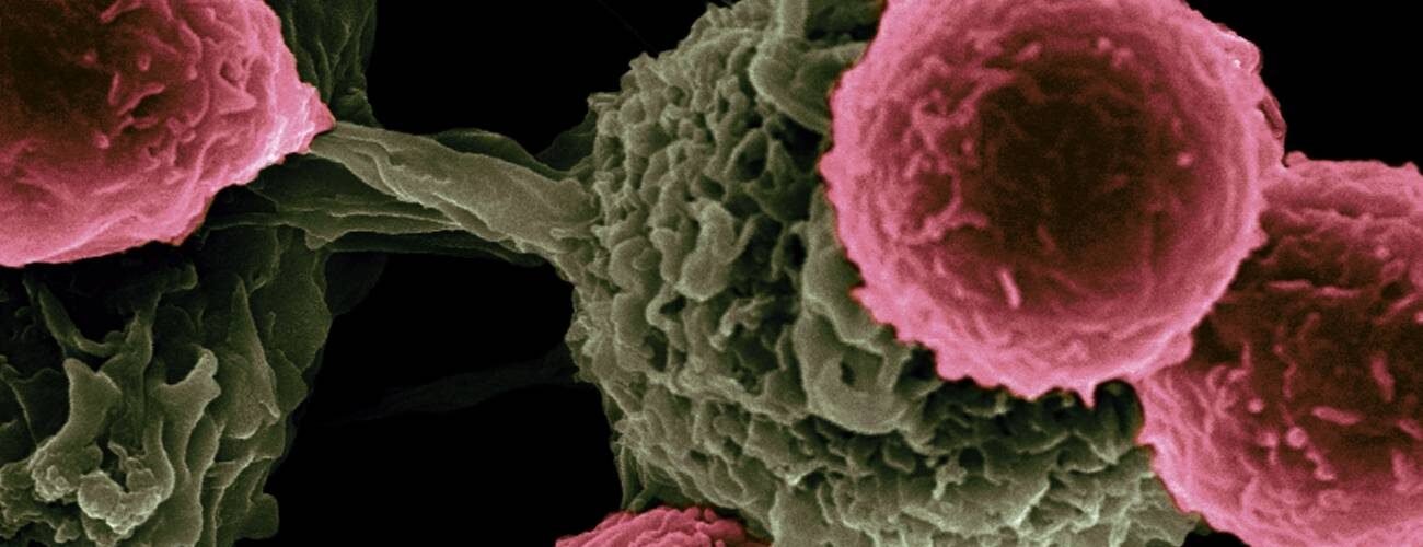 una nueva vacuna muestra potencial para prolongar la supervivencia en cancer de pancreas y colon