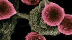 una nueva vacuna muestra potencial para prolongar la supervivencia en cancer de pancreas y colon