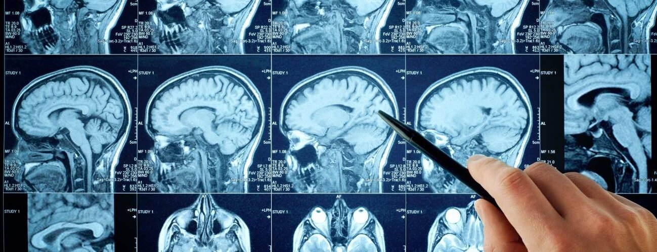 identifican por primera vez las senales cerebrales del olvido de recuerdos desagradables