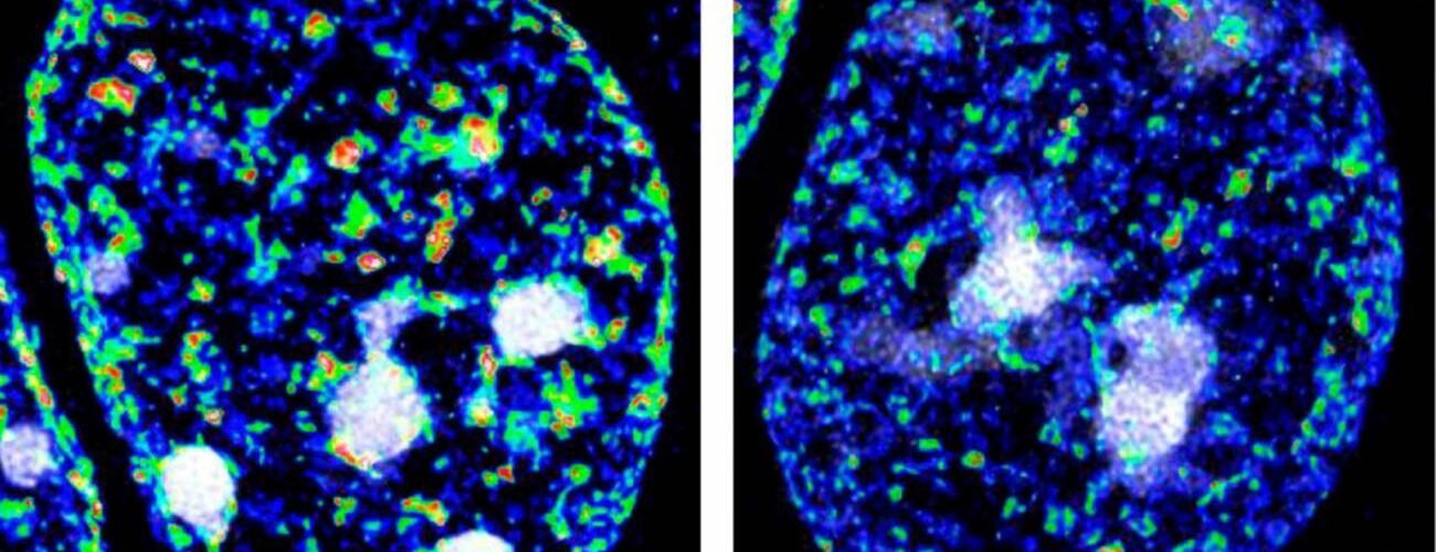 dos guardianes epigeneticos protegen la identidad de las neuronas