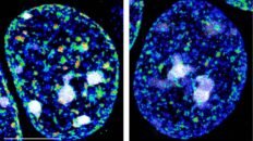 dos guardianes epigeneticos protegen la identidad de las neuronas